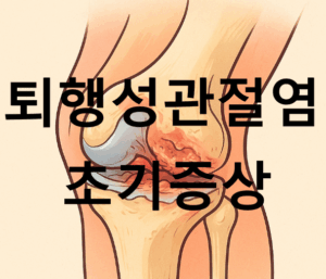 퇴행성관절염 초기증상